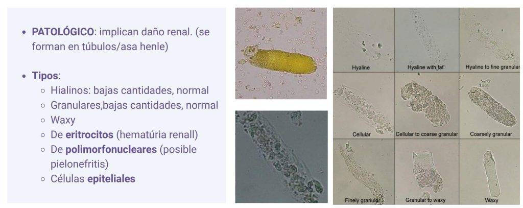 cristales en orina gato - Cristales en orina de gatos: tipos, síntomas y tratamiento