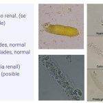 Cristales en orina de gatos: tipos, síntomas y tratamiento