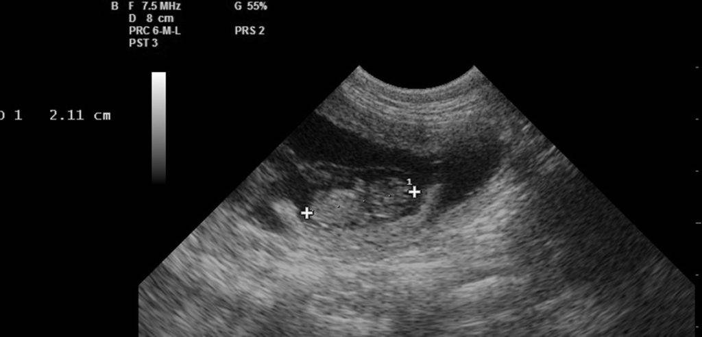 ecografia perro embarazo - Por qué es crucial la ecografía en el embarazo de perras