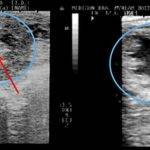 Endometritis en yeguas: síntomas, causas y tratamiento