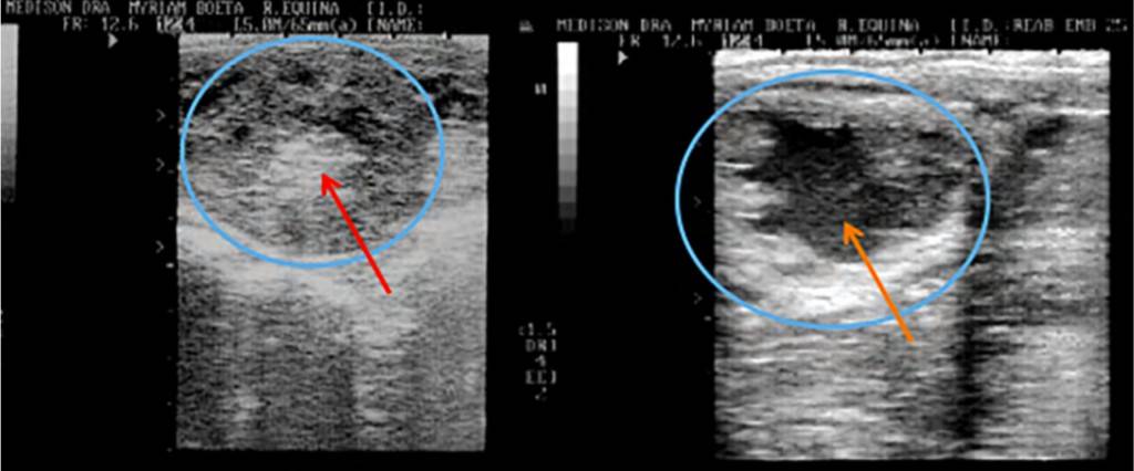 endometriosis en yeguas - Endometritis en yeguas: síntomas, causas y tratamiento