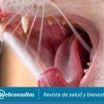 Qué es la estomatitis felina y cuáles son sus tratamientos