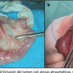 Cómo se puede tratar el prolapso rectal en perros de forma efectiva